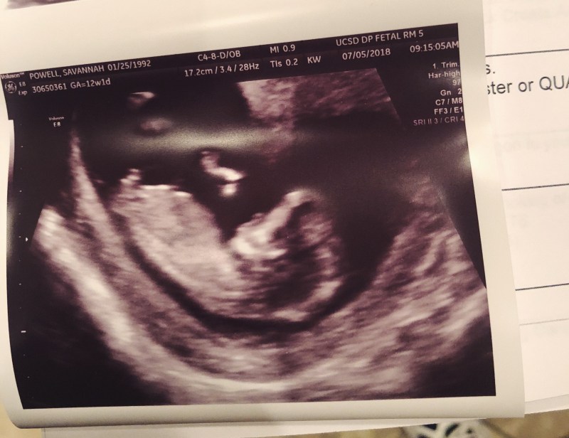 Processed with VSCO with f2 preset